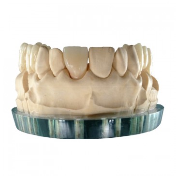 Composite-Disc Pressing Dental Smile-Cam Multicolor-micro-filled