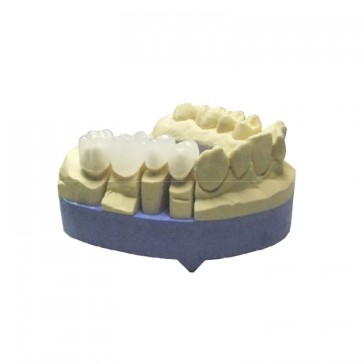 Composite-Disc Pressing Dental Smile-Cam disc PMMA-micro-filled-20 mm enamel 100% / 50%