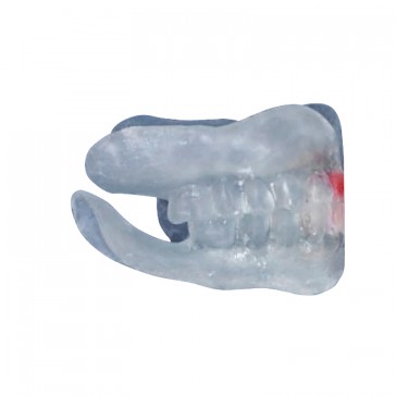 Composite-Disc Pressing Dental Ortho-Smile Compound elastic